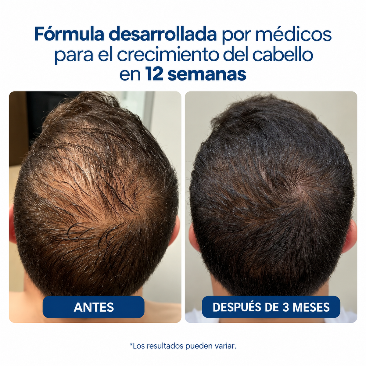 BODY WISE HAIR GROWTH SERUM – Sérum para Crecimiento y Densidad Capilar